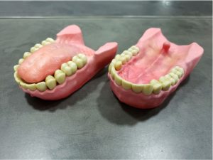 Impressao-3d-odontologia-arcada-dentaria-2